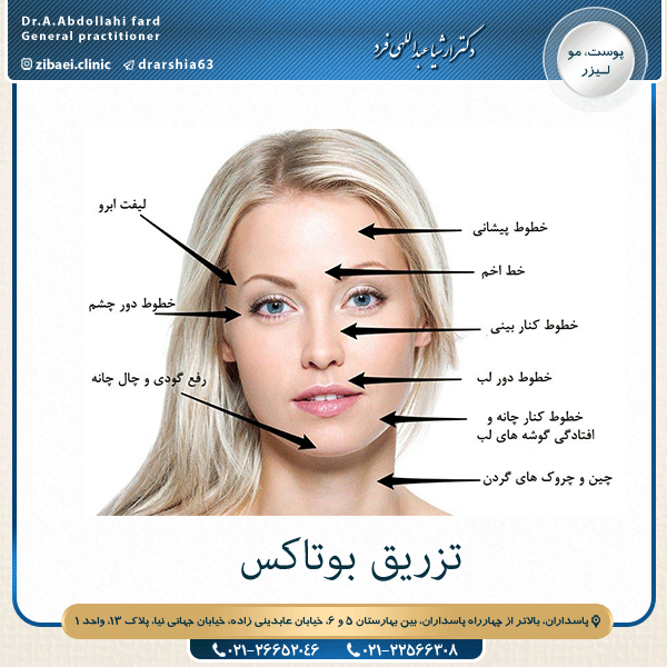 تزریق بوتاکس