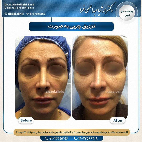 جوانسازی-عبداللهی فرد