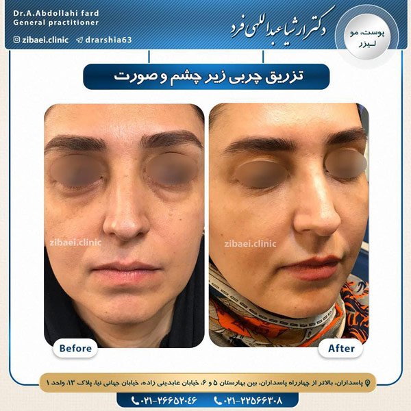 جوانسازی-دکتر عبداللهی فرد