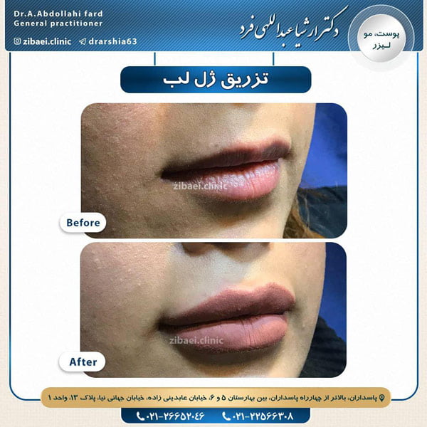 جوانسازی-دکتر عبداللهی فرد