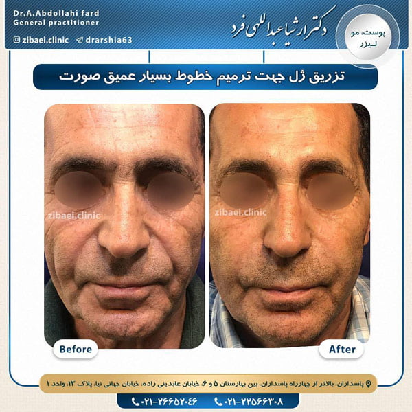 جوانسازی-دکتر عبداللهی فرد