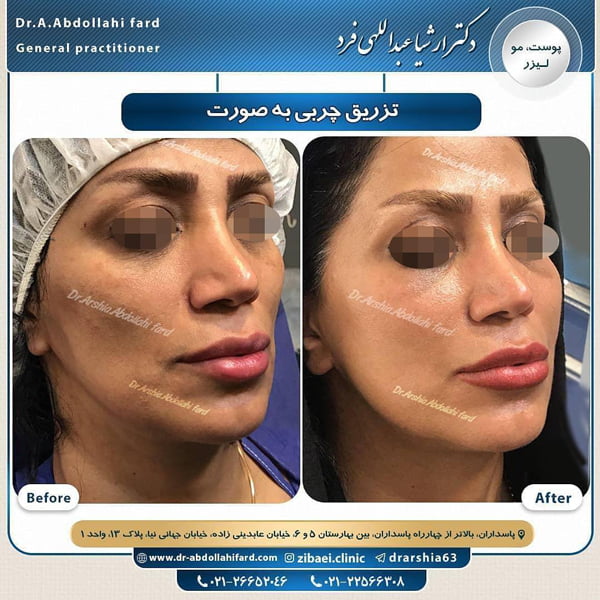 جوانسازی-دکتر عبداللهی فرد