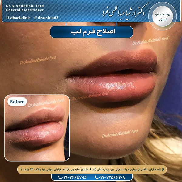 جوانسازی-دکتر عبداللهی فرد