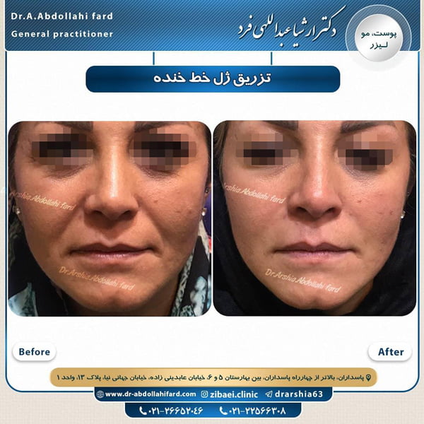 جوانسازی-دکتر عبداللهی فرد