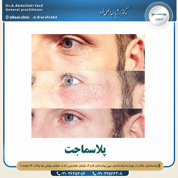پلاسماجت