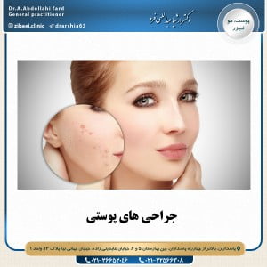 جراحی های پوستی