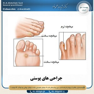 جراحی های پوستی