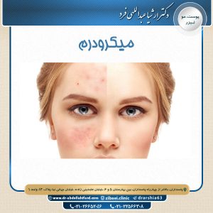میکرودرم - دکتر عبدالهی فرد
