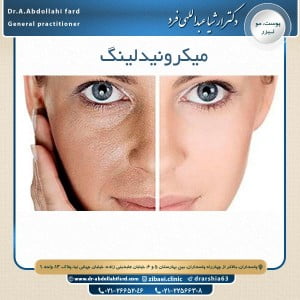 میکرونیدلینگ - دکتر عبدالهی فرد