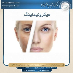 میکرونیدلینگ - دکتر عبدالهی فرد