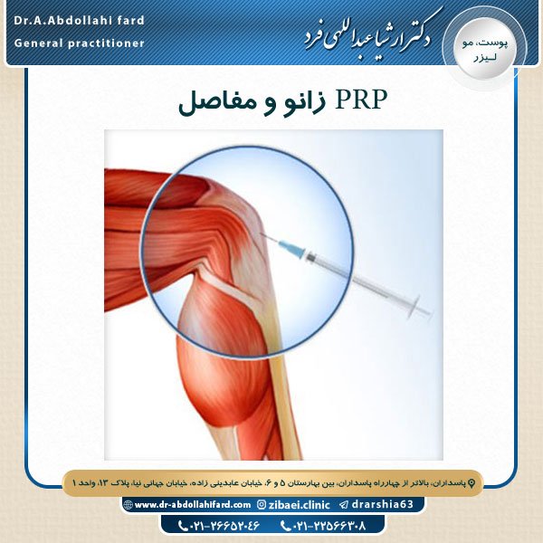PRP زانو و مفاصل