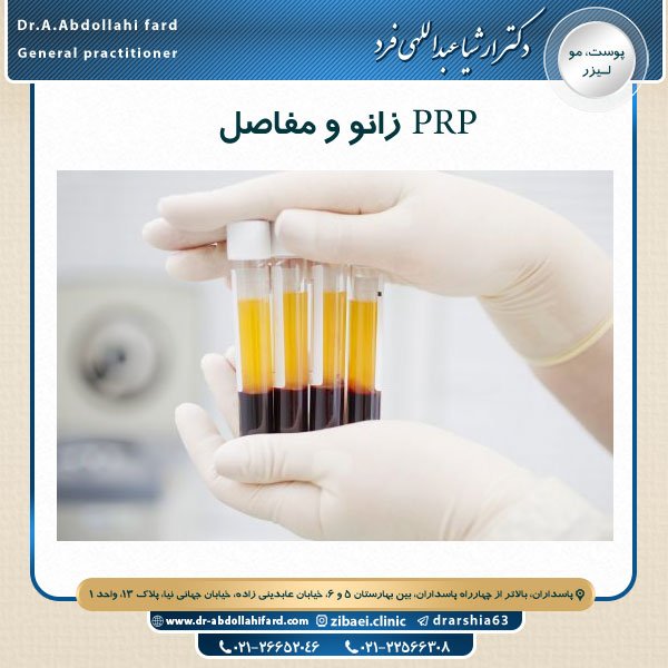 PRP زانو و مفاصل - دکتر ارشیا عبداالهی فرد در تهران