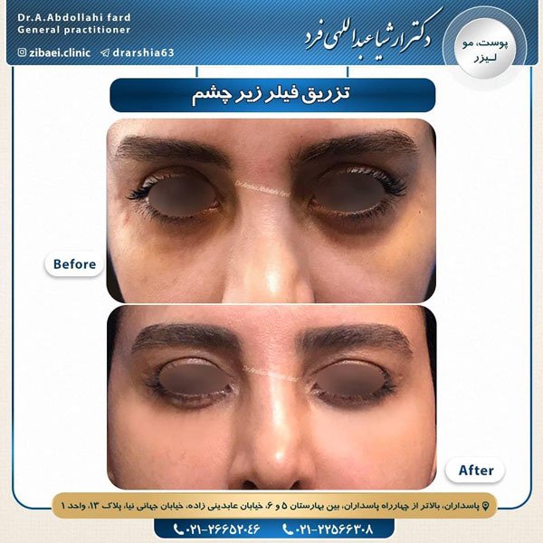 عکس جوانسازی پوست