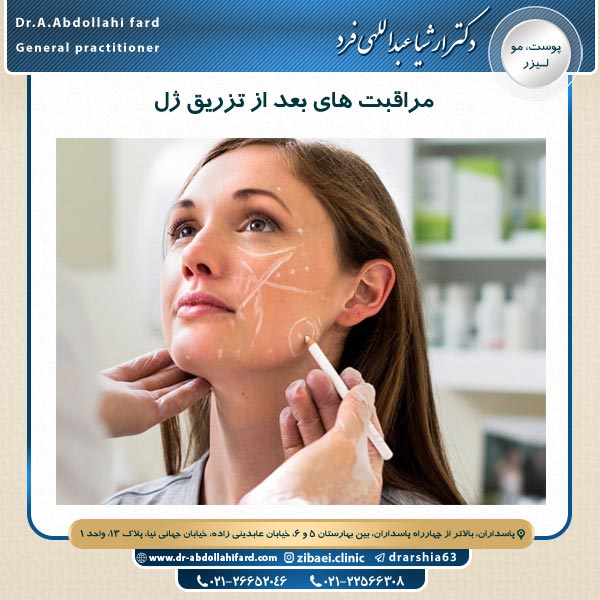مراقبت های بعد از تزریق ژل