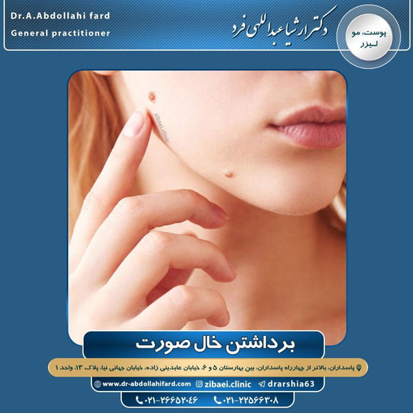 برداشتن خال