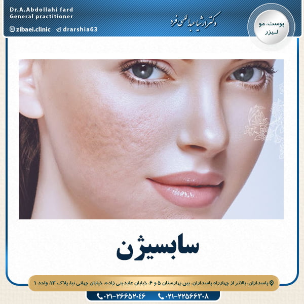 سابسیژن