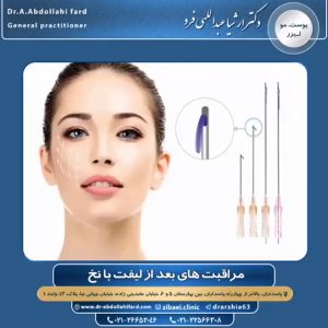 لیفت صورت - دکتر عبداللهی فرد