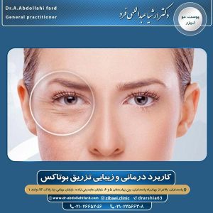 اقدامات قبل از تزریق بوتاکس
