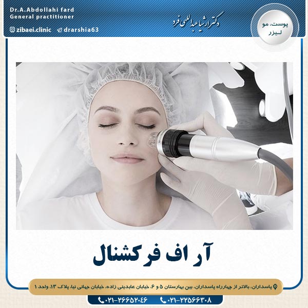 آر اف فرکشنال