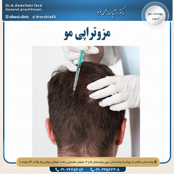 مزوتراپی مو - دکتر عبداللهی فرد
