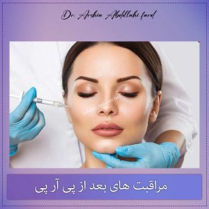 مراقبت های بعد از پی آر پی