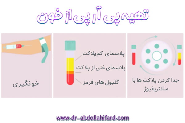 پی آر پی - دکتر ارشیا عبداللهی فرد