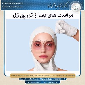 مراقبت های بعد از تزریق ژل | دکتر عبدالهی فرد