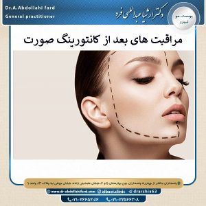 مراقبت های بعد از کانتورینگ صورت - دکتر ارشیا عبداللهی فرد