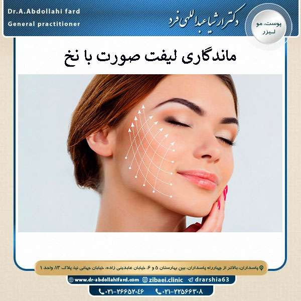 ماندگاری لیفت صورت با نخ _ دکتر ارشیا عبداللهی فرد
