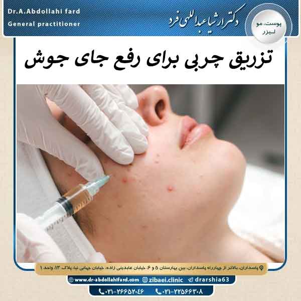 تزریق چربی برای رفع جای جوش