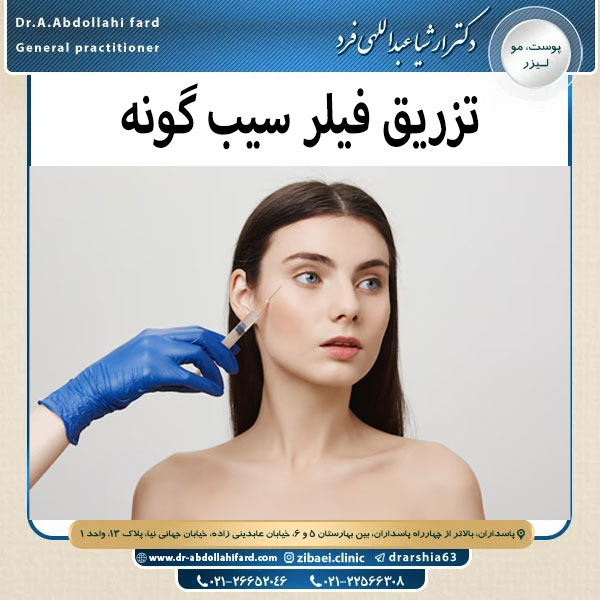 تزریق فیلر سیب گونه