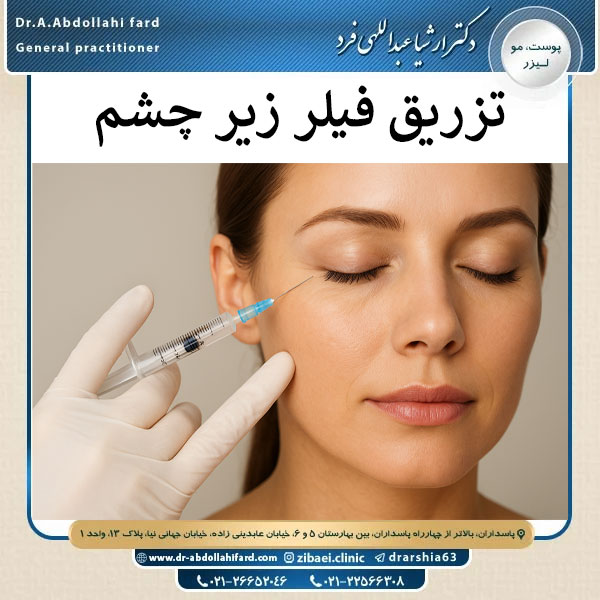 تزریق فیلر زیر چشم