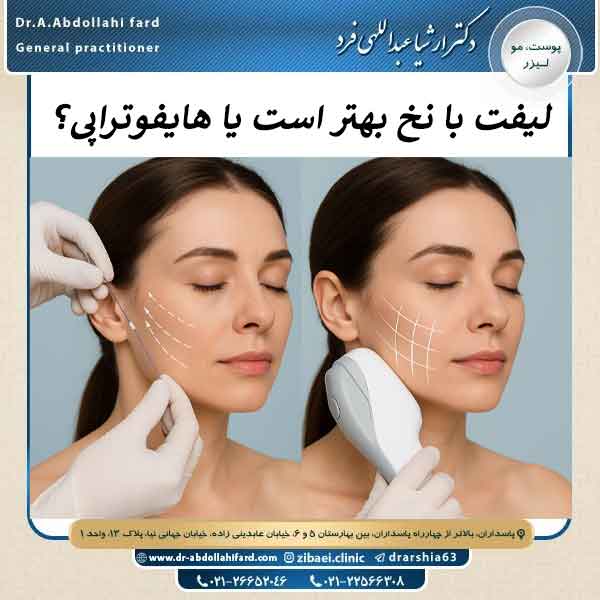 لیفت با نخ یا هافوتراپی