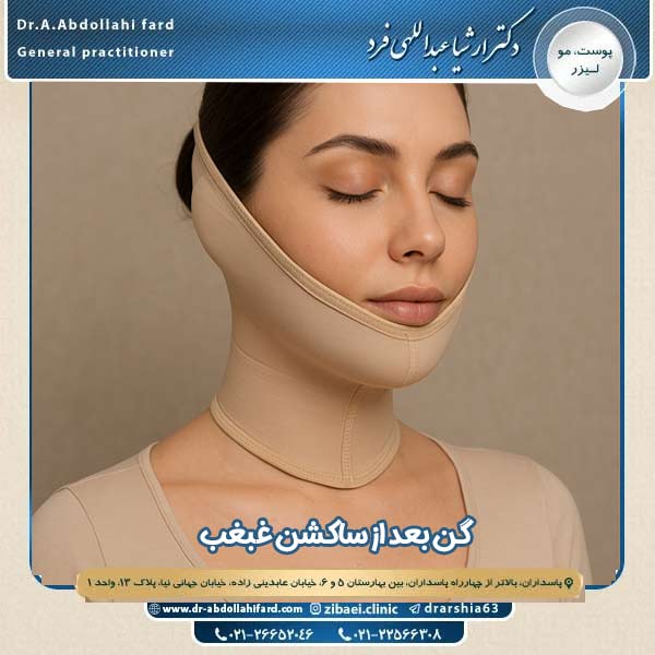 گن بعد از ساکشن غبغب - دکتر ارشیا عبداللهی فرد
