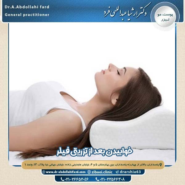 خوابیدن بعد از تزریق فیلر
