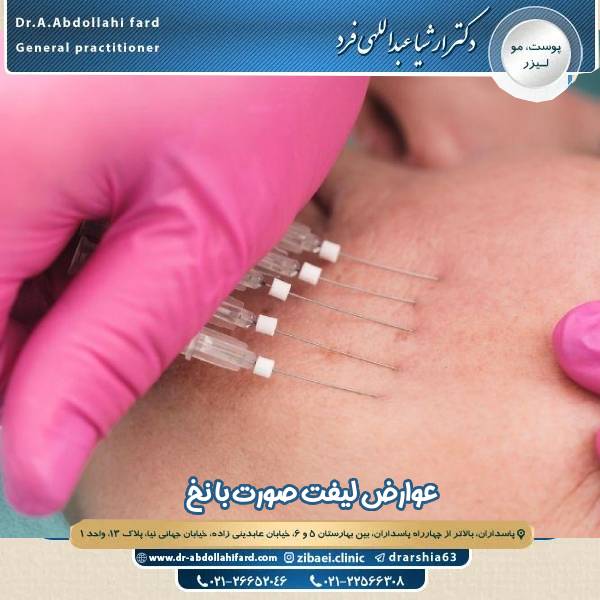 عوارض لیفت صورت