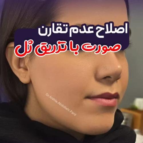 تزریق-ژل-در-تهران-111
