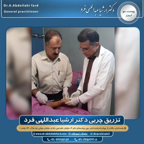 تزریق چربی در تهران 51