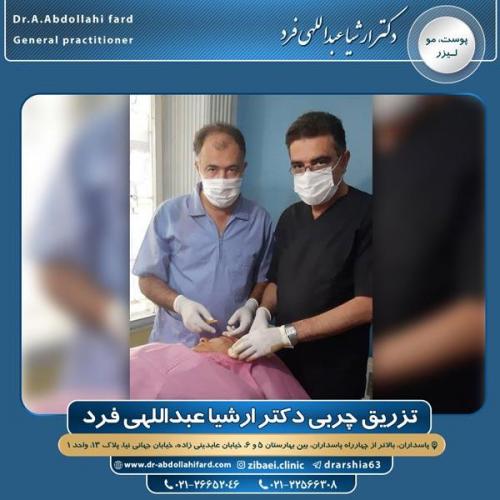 تزریق چربی در تهران 52